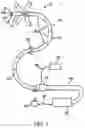 Fig. 02 - Segmented instrument having braking capabilities