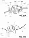 Fig. 17 - Segmented instrument having braking capabilities