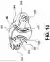 Fig. 18 - Segmented instrument having braking capabilities