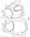 Fig. 06 - Endoscope with pannable camera