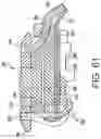 Fig. 43 - Endoscope with pannable camera