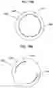 Fig. 14 - Adaptive configuration of an ophthalmic device