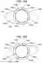 Fig. 15 - Adaptive configuration of an ophthalmic device