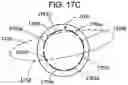 Fig. 16 - Adaptive configuration of an ophthalmic device