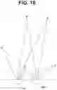 Fig. 17 - Adaptive configuration of an ophthalmic device