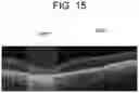 Fig. 15 - Ophthalmologic information processing apparatus, ophthalmologic system, ophthalmologic information processing method, and recording medium