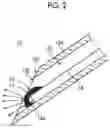 Fig. 03 - INSERT AND PHOTOACOUSTIC MEASUREMENT DEVICE COMPRISING INSERT