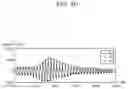 Fig. 12 - Apparatus and method for estimating bio-information