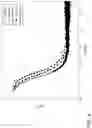 Fig. 07 - SYSTEMS AND METHODS FOR REVASCULARIZATION ASSESSMENT