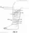 Fig. 09 - Apparatus and methods of sensing a patient condition, such as anatomy position, and of controlling patient applications
