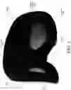 Fig. 04 - Diagnostic mask and method