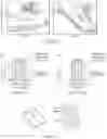 Fig. 10 - SYSTEMS, DEVICES, AND METHOD FOR THE TREATMENT OF OSTEOARTHRITIS