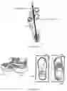 Fig. 11 - SYSTEMS, DEVICES, AND METHOD FOR THE TREATMENT OF OSTEOARTHRITIS