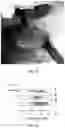 Fig. 12 - Systems and methods for transdermally detecting tissue ischemia and evaluating organ function using serum luminescence