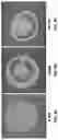 Fig. 07 - THIN, SOFT, SKIN-MOUNTED MICROFLUIDIC NETWORKS FOR DETECTION AND ANALYSIS OF TARGETS OF INTEREST IN SWEAT