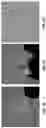 Fig. 08 - THIN, SOFT, SKIN-MOUNTED MICROFLUIDIC NETWORKS FOR DETECTION AND ANALYSIS OF TARGETS OF INTEREST IN SWEAT