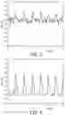 Fig. 03 - METHOD OF CHARACTERIZING SLEEP DISORDERED BREATHING