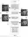 Fig. 01 - METHOD AND SYSTEM OF OBSTRUCTED AREA DETERMINATION FOR SLEEP APNEA SYNDROME