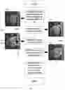Fig. 04 - METHOD AND SYSTEM OF OBSTRUCTED AREA DETERMINATION FOR SLEEP APNEA SYNDROME