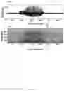 Fig. 07 - METHOD AND SYSTEM OF OBSTRUCTED AREA DETERMINATION FOR SLEEP APNEA SYNDROME