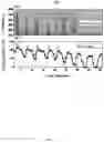 Fig. 09 - METHOD AND SYSTEM OF OBSTRUCTED AREA DETERMINATION FOR SLEEP APNEA SYNDROME