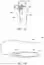 Fig. 11 - Implantable reporting processor for an alert implant