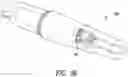 Fig. 07 - Implantable reporting processor for an alert implant