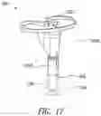 Fig. 17 - Implantable reporting processor for an alert implant