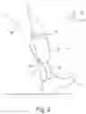 Fig. 03 - DEVICE AND METHOD FOR DETERMINING AN INCORRECT POSITIONING IN THE ALIGNMENT OF PROSTHESES