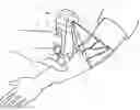 Fig. 01 - Micro vein enhancer for hands-free imaging for a venipuncture procedure