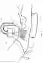 Fig. 12 - Micro vein enhancer for hands-free imaging for a venipuncture procedure