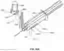 Fig. 22 - Micro vein enhancer for hands-free imaging for a venipuncture procedure