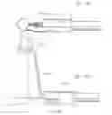 Fig. 23 - Micro vein enhancer for hands-free imaging for a venipuncture procedure