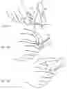 Fig. 26 - Micro vein enhancer for hands-free imaging for a venipuncture procedure