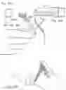 Fig. 31 - Micro vein enhancer for hands-free imaging for a venipuncture procedure