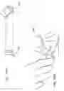 Fig. 32 - Micro vein enhancer for hands-free imaging for a venipuncture procedure