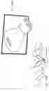 Fig. 37 - Micro vein enhancer for hands-free imaging for a venipuncture procedure