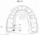 Fig. 04 - WEARABLE APPARATUS ATTACHING ON TOOTH AND THE SENSING DEVICE FIXING AT TOOTH