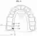 Fig. 05 - WEARABLE APPARATUS ATTACHING ON TOOTH AND THE SENSING DEVICE FIXING AT TOOTH