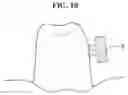 Fig. 10 - WEARABLE APPARATUS ATTACHING ON TOOTH AND THE SENSING DEVICE FIXING AT TOOTH