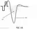 Fig. 05 - Eliminating acquisition-related artifacts in electrophysiological recording