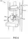 Fig. 06 - Breast securement devices
