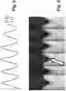 Fig. 03 - Automated computation of trigger delay for triggered magnetic resonance imaging sequences