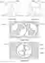 Fig. 12 - X-ray reduction system