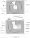 Fig. 15 - X-ray reduction system