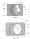 Fig. 17 - X-ray reduction system