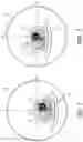 Fig. 03 - IMAGE-ASSISTED AUTOMATIC PATIENT POSITINING FOR IMPROVED IMAGING PERFORMANCE