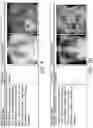 Fig. 09 - Method and system of building hospital-scale chest X-ray database for entity extraction and weakly-supervised classification and localization of common thorax diseases