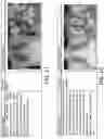 Fig. 10 - Method and system of building hospital-scale chest X-ray database for entity extraction and weakly-supervised classification and localization of common thorax diseases