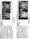 Fig. 11 - Method and system of building hospital-scale chest X-ray database for entity extraction and weakly-supervised classification and localization of common thorax diseases